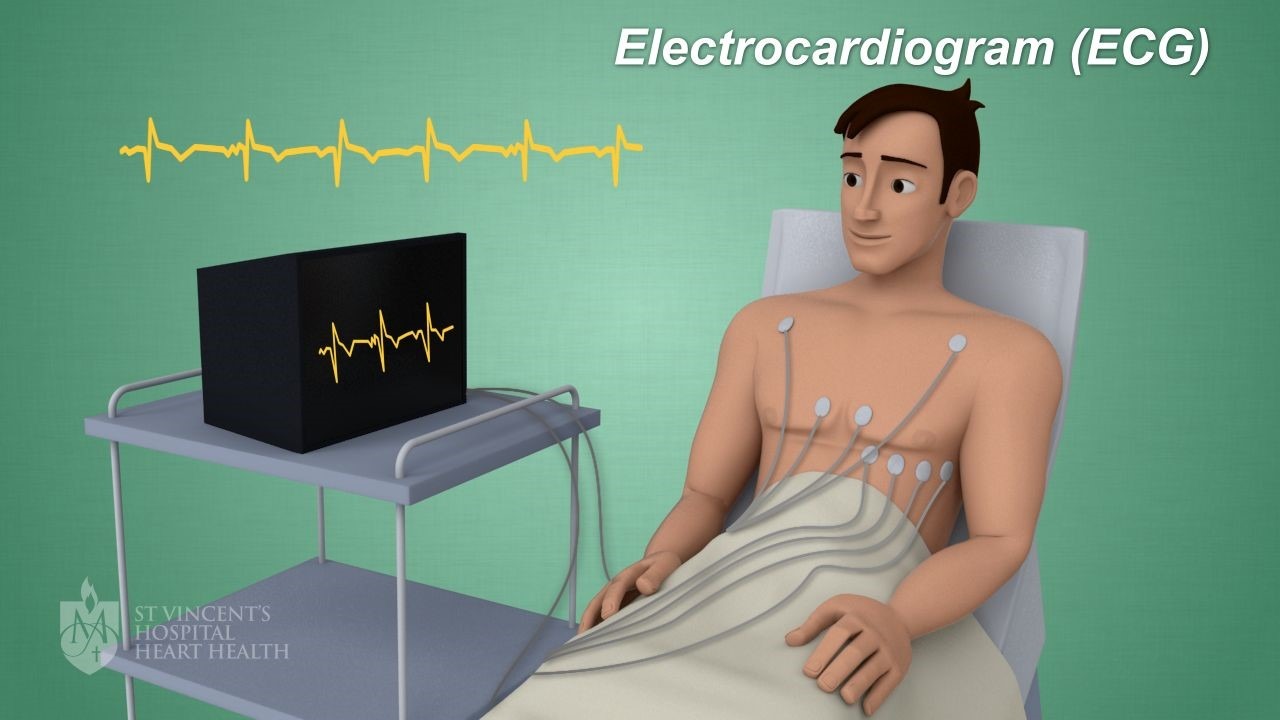 الکتروکاردیوگرام یا ECG چیست دانشنامه ردرونیک مقدمه ای بر ECG و